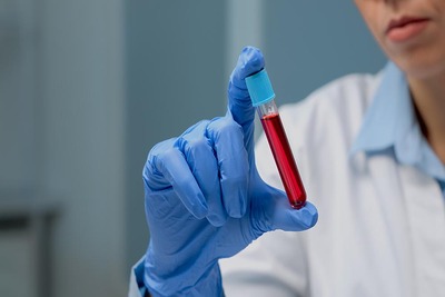 Analisi del sangue: colesterolo e profilo lipidico
